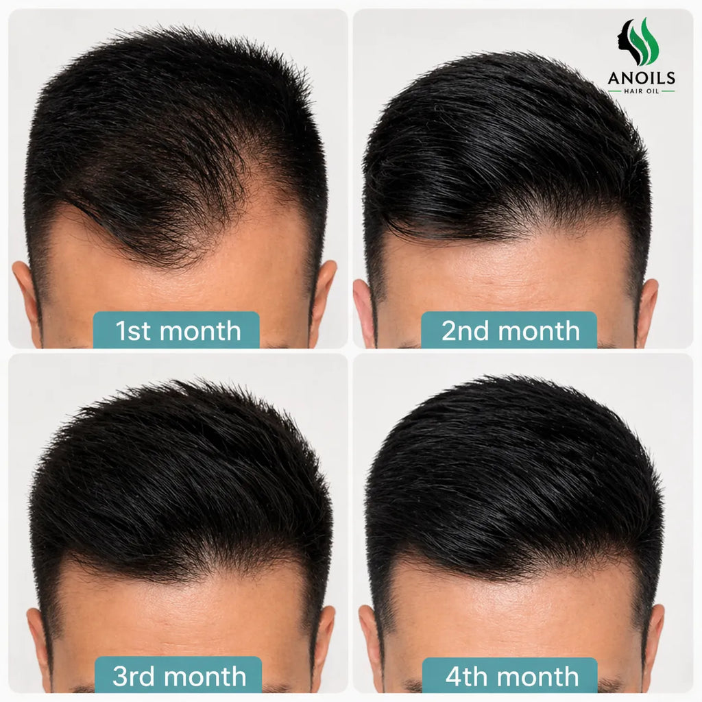 Herbal Hair Growth Oil – Anti Hair Fall